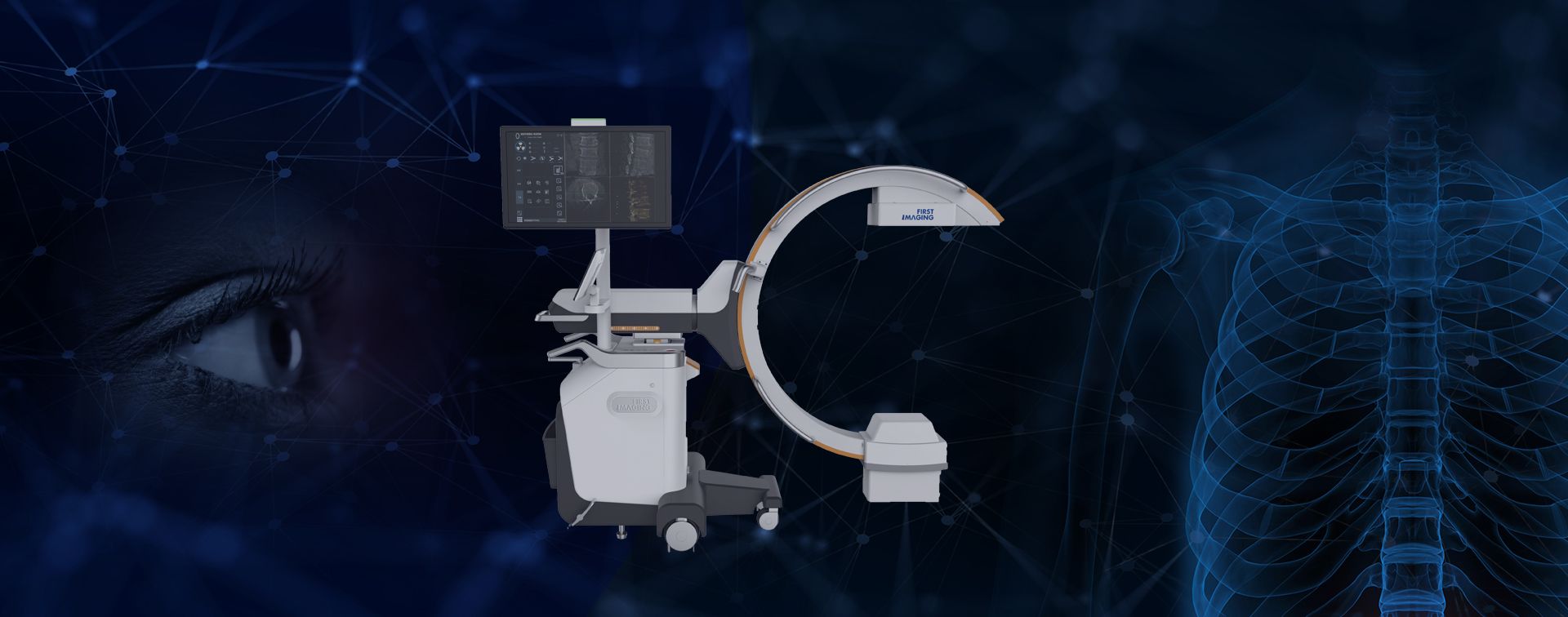 Mobile 3D C-arm Combo-S系列